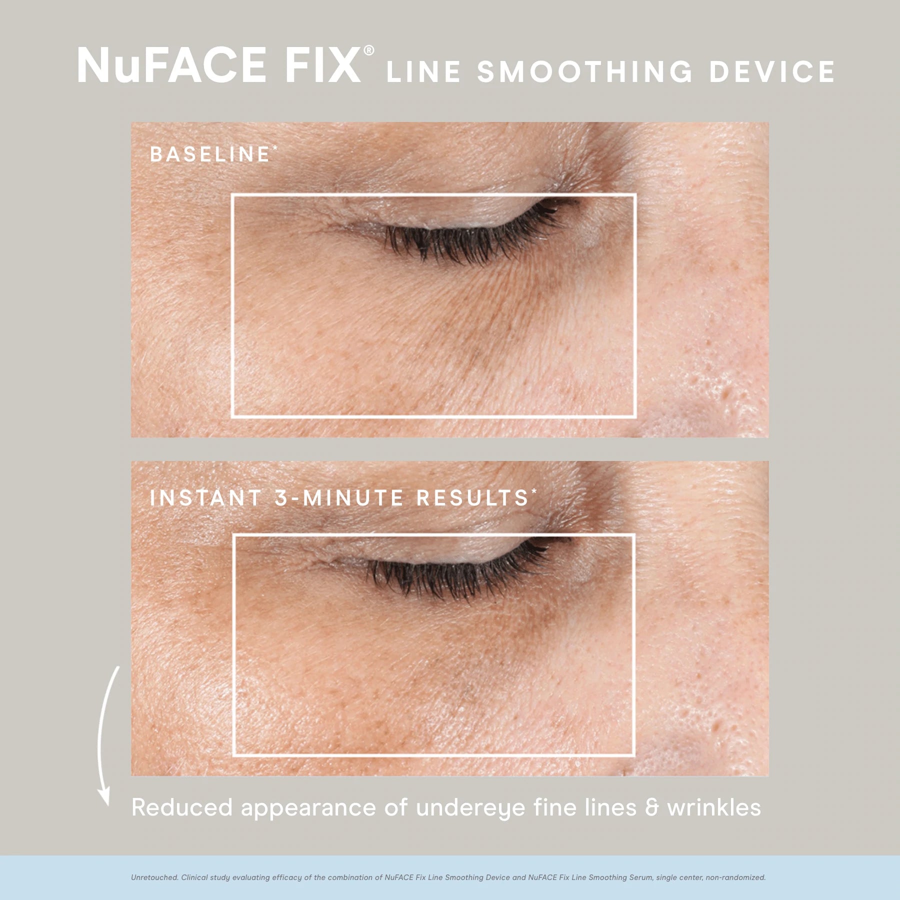 NuFace Fix Facial Toning Device